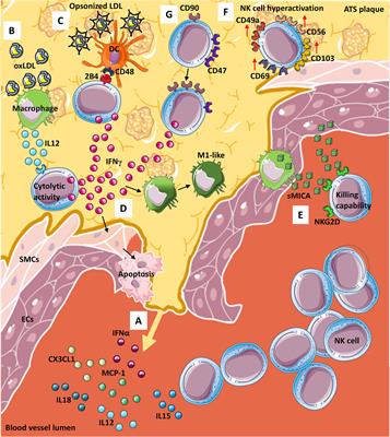 When a Friend Becomes Your Enemy: Natural Killer Cells in Atherosclerosis and Atherosclerosis-Associated Risk Factors
